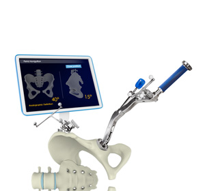 Augmented Reality Navigation Total Hip Replacement