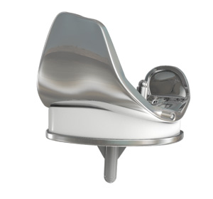 Knee Implants