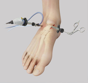 Orthopedic Surgery