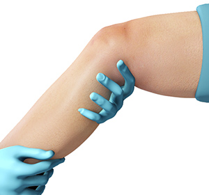 Physical Therapy for Knee