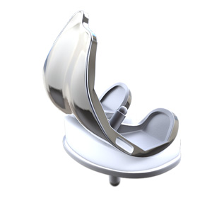 What is New in Knee Replacement