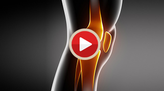 Patient Education Videos - Joshua Silver MD