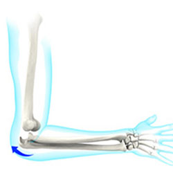 elbow dislocation