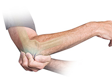 Elbow Stiffness Surgery