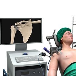 Failed Shoulder Surgery
