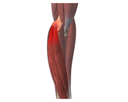 Golfer Elbow