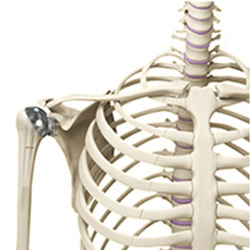 minimally invasive shoulder joint replacement