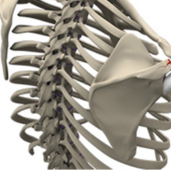 shoulder fracture