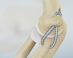 UCL Reconstruction