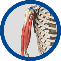 Picture of Biceps Tendon Issues