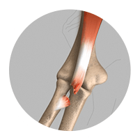 Picture of Elbow