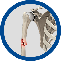 Picture of Fractures and Trauma