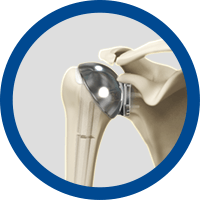 Picture of Other Conditions