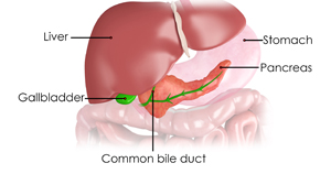 Biliary Tract Disease in Children - picture