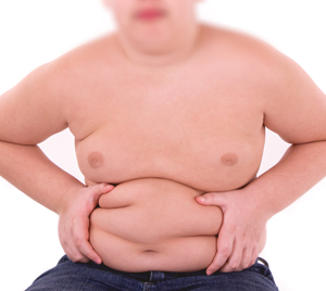 Childhood Obesity - picture