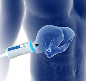 FibroScan educational picture