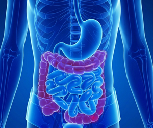Inflammatory Bowel Disease (IBD) - picture
