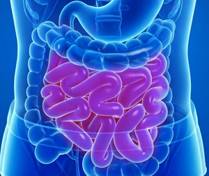 Malabsorption - picture