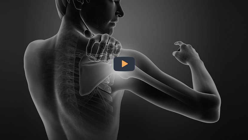 Patient Education Video