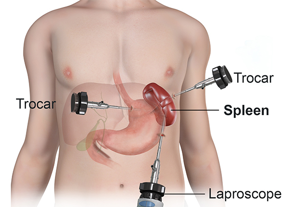 General Surgery