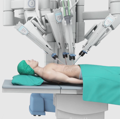 Robotic surgery