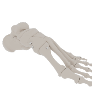Lisfranc Stabilization