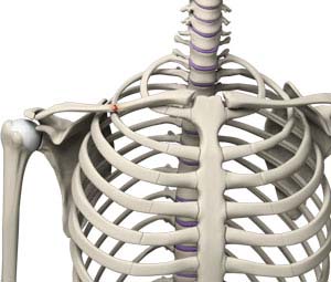 Clavicle Fracture - pic