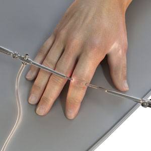 Finger Joint Arthroscopy - pic