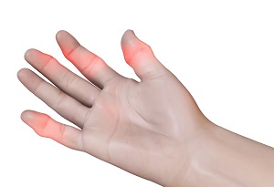 Finger Sprain - pic