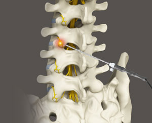 Manual Therapy - pic