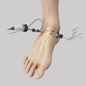 Orthopedic Surgery - pic