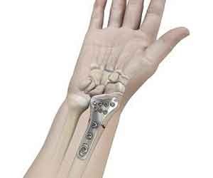 Pediatric Orthopedic Surgery - pic