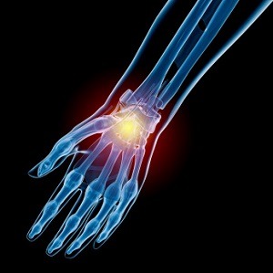 Hand and Wrist Sports Injuries - pic