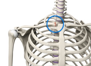 Sternoclavicular Separation - pic