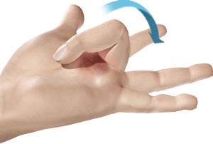 Trigger Finger - pic