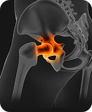 &nbsp;Hip