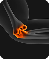 &nbsp;Elbow