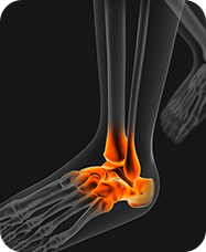 &nbsp;Ankle & Foot