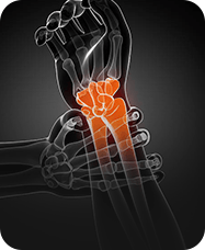 &nbsp;General Orthopedics