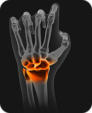 &nbsp;Hand & Wrist