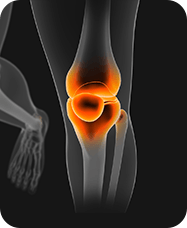 &nbsp;Knee