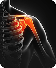 &nbsp;Shoulder