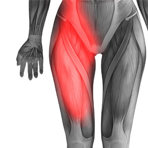 Picture of Hip Flexor Pain