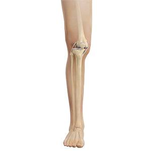 Picture of Knee Dislocation