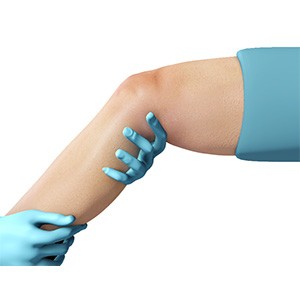 Picture of Physical Therapy for Knee