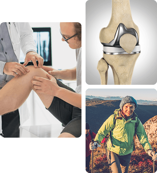 Picture of Robotic-Assisted Knee Replacement