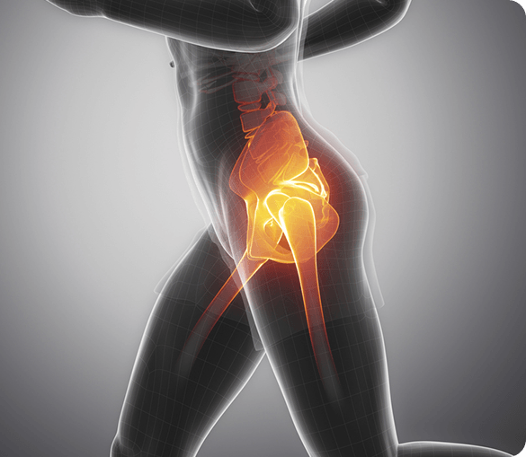 Hip joint illustration for hip replacement and reconstruction services