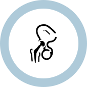 Hip replacement procedure