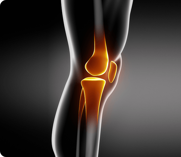 Knee joint illustration for knee replacement and reconstruction services