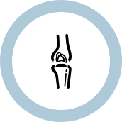 Knee replacement procedure